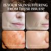 Essence Combination, Anti-aging Firming Hydrating And Brightening Dark Yellow Skin Essence